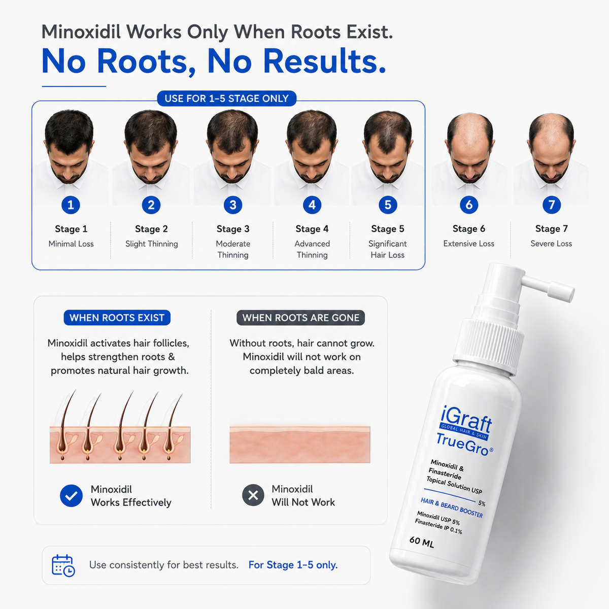 Follica Advanced Scalp Solution 5%  TrueGro™