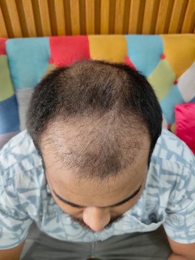 Before